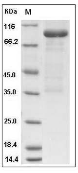 Human LRP10 Protein (Fc Tag) SDS-PAGE