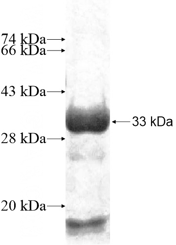 Recombinant Human GLT25D1 SDS-PAGE