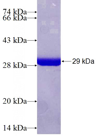 Recombinant Human RANGAP1 SDS-PAGE