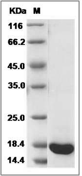Rat REG3A Protein (His Tag) SDS-PAGE