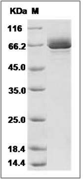 Human EphB1 / EPHT2 Protein (aa 565-984, His & GST Tag) SDS-PAGE