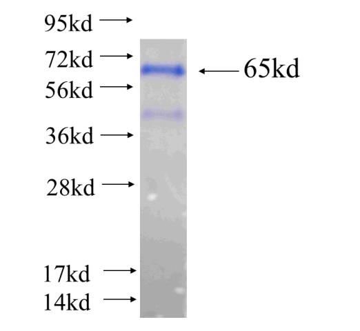 Recombinant human KRT34 SDS-PAGE
