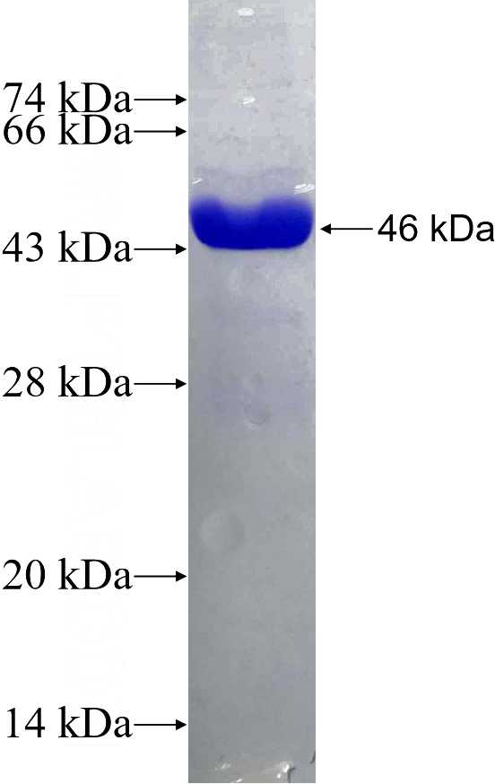 Recombinant Human RAB14 SDS-PAGE