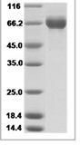 Influenza A H3N2 (A/Wuhan/359/1995) Hemagglutinin / HA Protein (His Tag)