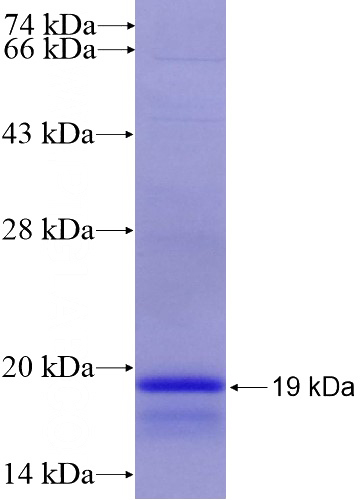 Recombinant Human KISS1R SDS-PAGE