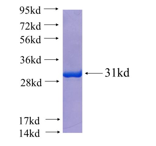 Recombinant human RARA SDS-PAGE