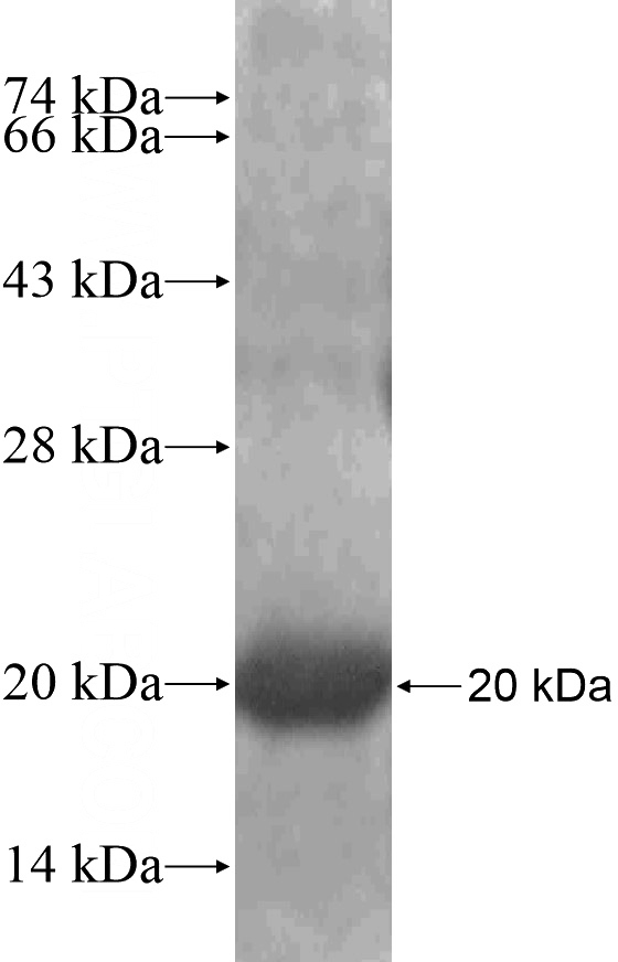 Recombinant Human Kindlin 1 SDS-PAGE