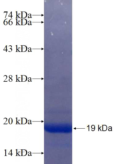 Recombinant Human SLC12A9 SDS-PAGE