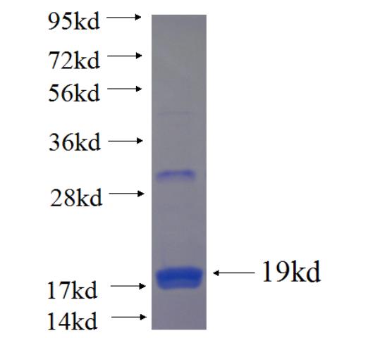 Recombinant human ZNF649 SDS-PAGE
