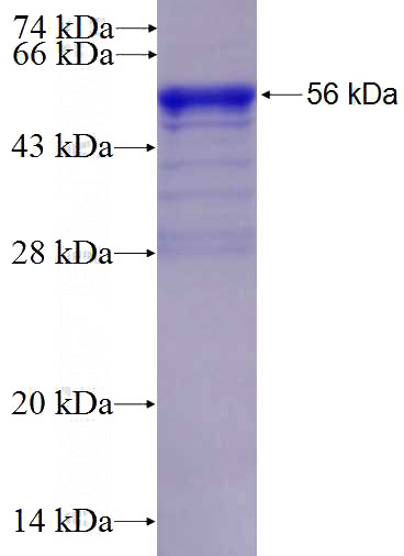 Recombinant Human BCAS3 SDS-PAGE