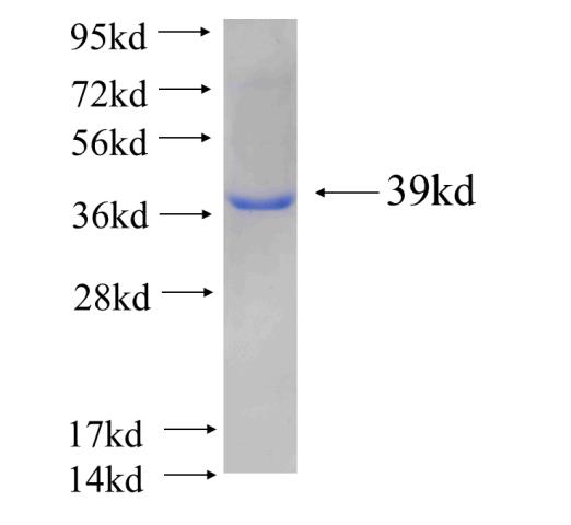 Recombinant human ELP4 SDS-PAGE