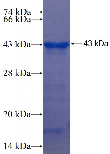Recombinant Human TBC1D9 SDS-PAGE
