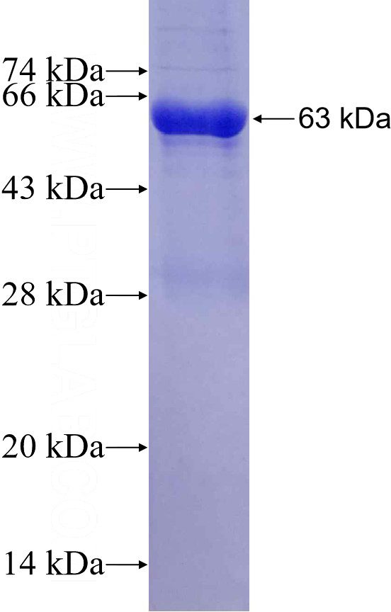 Recombinant human NEU4 SDS-PAGE