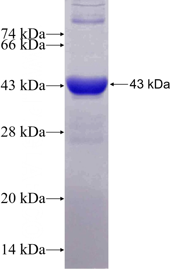 Recombinant Human TLN1 SDS-PAGE