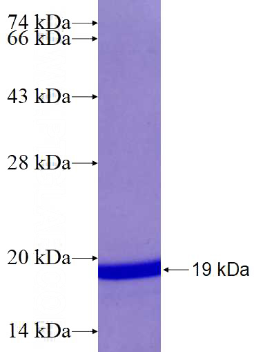 Recombinant Human MSI1 SDS-PAGE