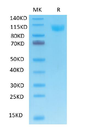Human ACE2 (His tag) recombinant protein
