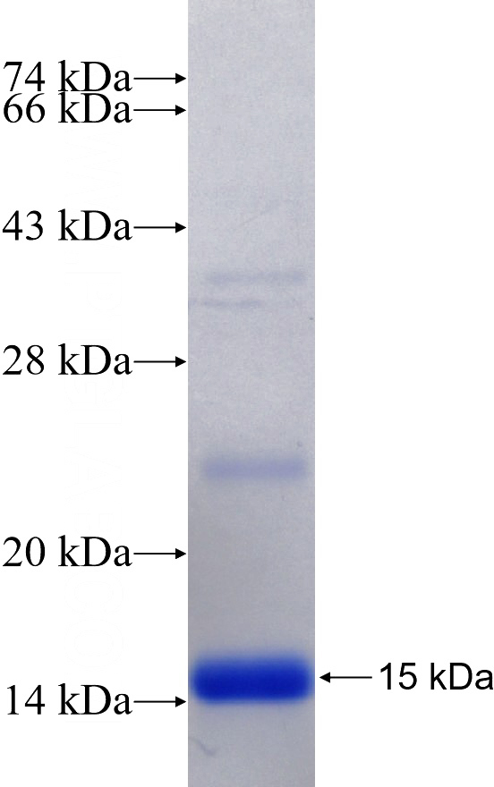 Recombinant Human TLE4 SDS-PAGE