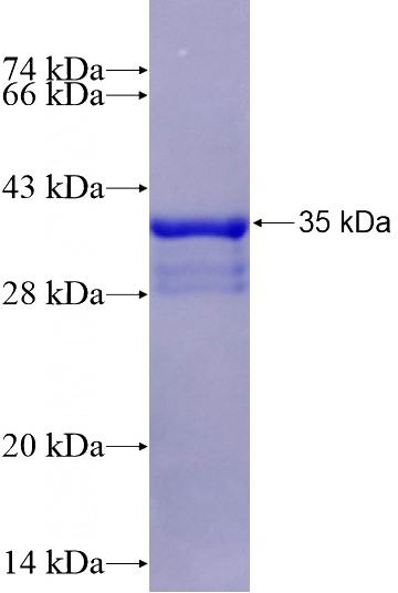 Recombinant Human CEBPB SDS-PAGE