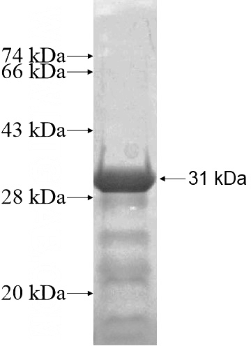 Recombinant Human ZBED2 SDS-PAGE