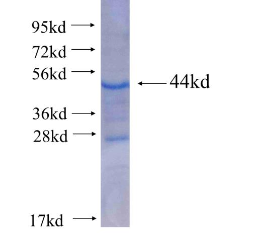 Recombinant human HPS5 SDS-PAGE