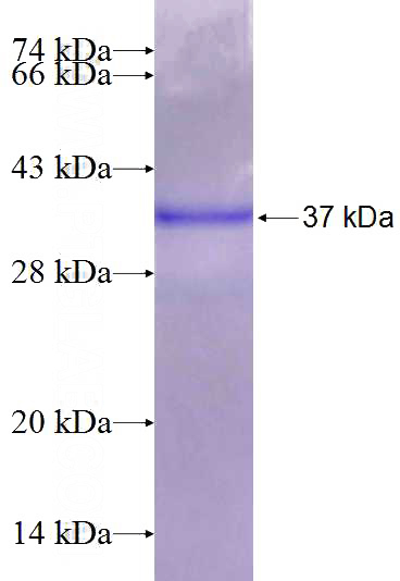Recombinant Human Cyclin D1 SDS-PAGE