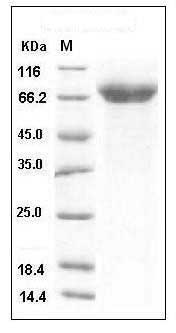 Human ADAM15 / MDC15 Protein (His Tag) SDS-PAGE
