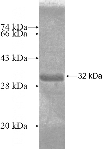 Recombinant Human SCAND1 SDS-PAGE