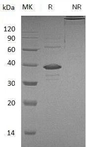 Human RETN/FIZZ3/HXCP1/RSTN (Fc tag) recombinant protein