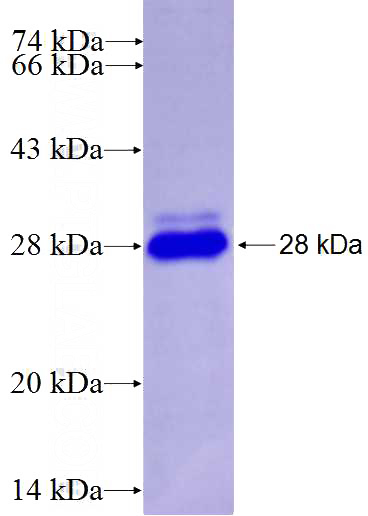 Recombinant Human ZNF555 SDS-PAGE