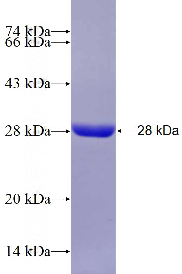 Recombinant Human CYP7A1 SDS-PAGE