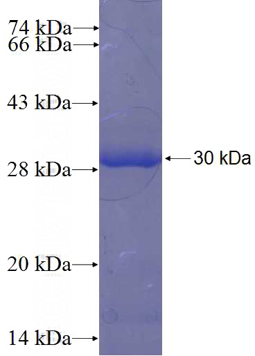 Recombinant Human CBARA1 SDS-PAGE