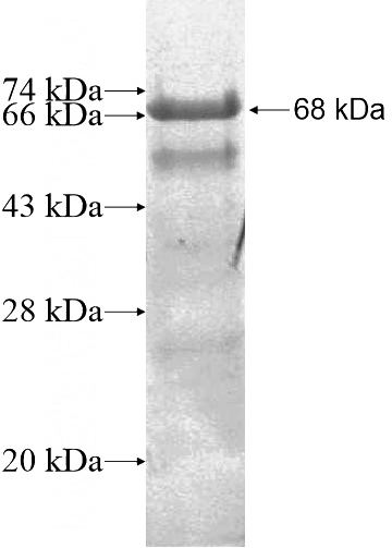Recombinant Human ANKZF1 SDS-PAGE