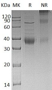 Human KIR2DL4/CD158D/KIR103AS (His tag) recombinant protein