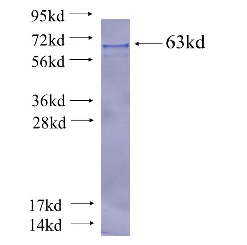 Recombinant human CP110 SDS-PAGE