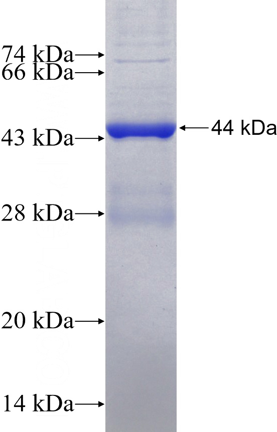 Recombinant Human NFKBIZ SDS-PAGE