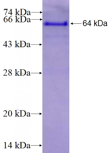 Recombinant Human RIC8A SDS-PAGE