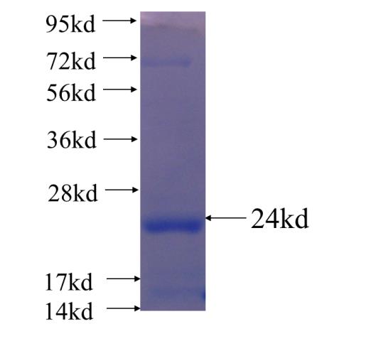 Recombinant human LRP6 SDS-PAGE