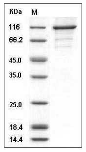 Human CASK Kinase Protein (His & GST Tag) SDS-PAGE