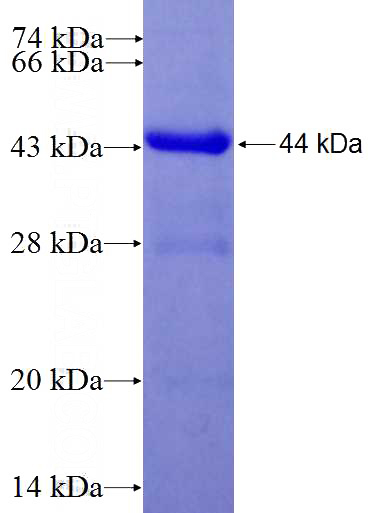 Recombinant Human Integrin alpha-9 SDS-PAGE