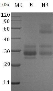 Human VEGFC (His tag) recombinant protein