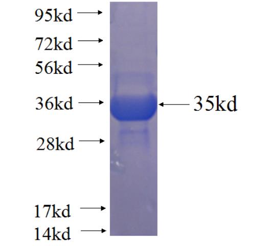 Recombinant human SPANXN4 SDS-PAGE
