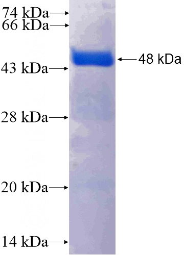 Recombinant Human ZNF581 SDS-PAGE
