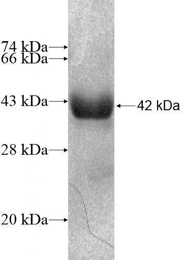 Recombinant Human LGALS13 SDS-PAGE