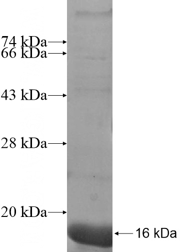 Recombinant Human ARL10 SDS-PAGE