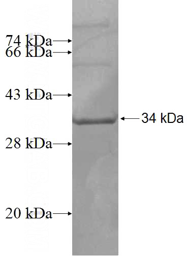 Recombinant Human TSSC4 SDS-PAGE
