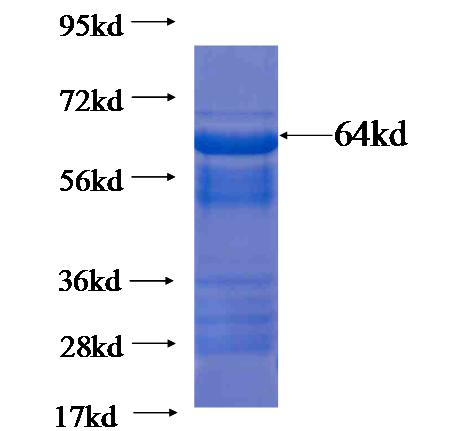 Recombinant human ANKRD50 SDS-PAGE