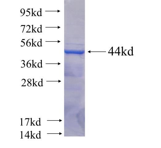 Recombinant human KLHL29 SDS-PAGE