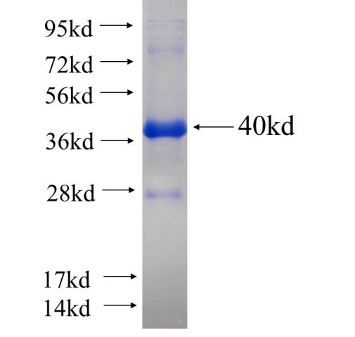 Recombinant human PIBF1 SDS-PAGE