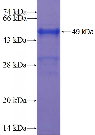 Recombinant Human CCDC33 SDS-PAGE