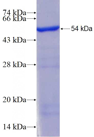 Recombinant Human NAT10 SDS-PAGE